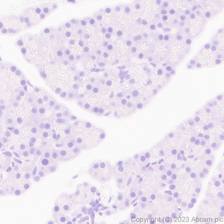 Immunohistochemistry (Formalin/PFA-fixed paraffin-embedded sections) - Anti-IRF4 antibody [EPR28687-87] - BSA and Azide free (AB315395)