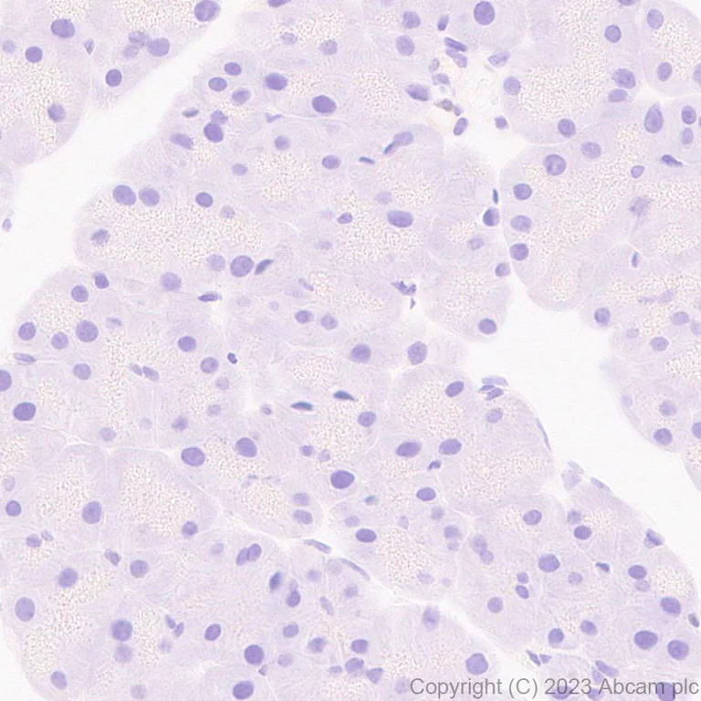 Immunohistochemistry (Formalin/PFA-fixed paraffin-embedded sections) - Anti-IRF4 antibody [EPR28687-87] - BSA and Azide free (AB315395)