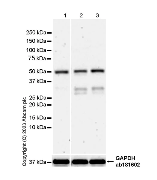 Western blot - Anti-IRF4 antibody [EPR28687-87] - BSA and Azide free (AB315395)