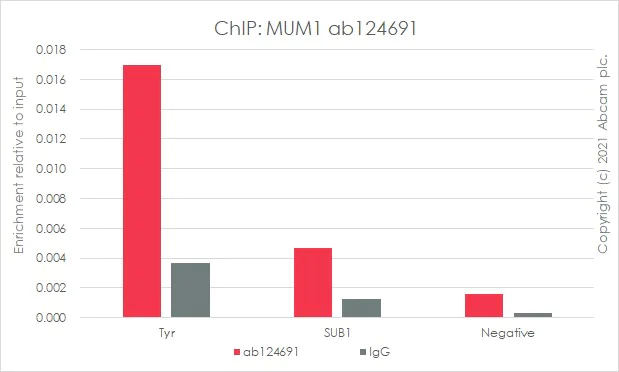 ChIP - Anti-IRF4 antibody [EPR5653] (AB124691)