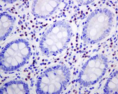 Immunohistochemistry (Formalin/PFA-fixed paraffin-embedded sections) - Anti-IRF4 antibody [EPR5653] (AB124691)