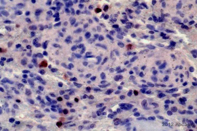 Immunohistochemistry (Formalin/PFA-fixed paraffin-embedded sections) - Anti-IRF4 antibody [EPR5653] (AB124691)