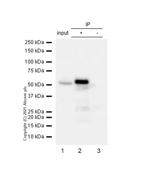 Immunoprecipitation - Anti-IRF4 antibody [EPR5653] (AB124691)