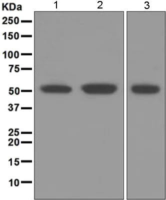 Western blot - Anti-IRF4 antibody [EPR5653] (AB124691)