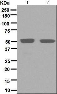 Western blot - Anti-IRF4 antibody [EPR5654(2)] (AB133298)