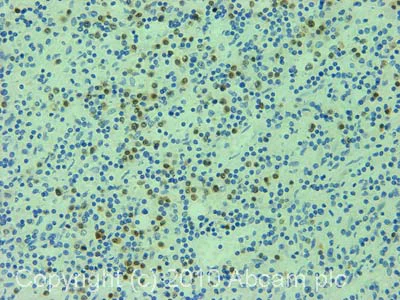 Immunohistochemistry (Formalin/PFA-fixed paraffin-embedded sections) - Anti-IRF4 antibody [MUM1p] (AB12501)