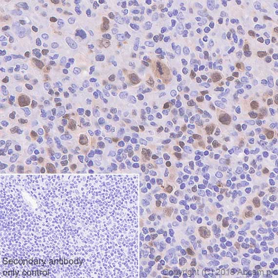 Immunohistochemistry (Formalin/PFA-fixed paraffin-embedded sections) - Anti-IRF4 antibody [SP114] - BSA and Azide free (AB242427), expandable thumbnail