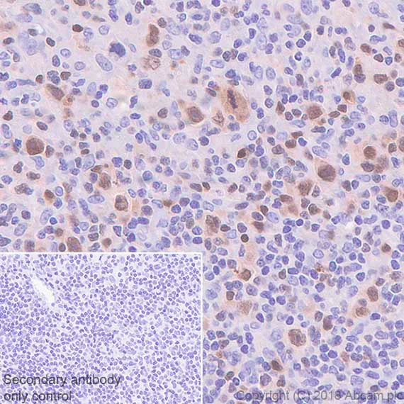 Immunohistochemistry (Formalin/PFA-fixed paraffin-embedded sections) - Anti-IRF4 antibody [SP114] - BSA and Azide free (AB242427)