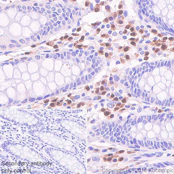 Immunohistochemistry (Formalin/PFA-fixed paraffin-embedded sections) - Anti-IRF4 antibody [SP114] - BSA and Azide free (AB242427)