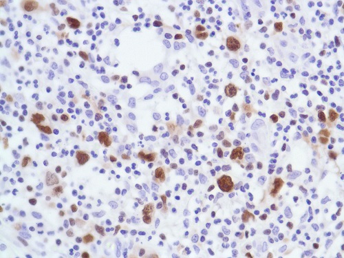Immunohistochemistry (Formalin/PFA-fixed paraffin-embedded sections) - Anti-IRF4 antibody [SP114] - BSA and Azide free (AB242427), expandable thumbnail