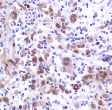 Immunohistochemistry (Formalin/PFA-fixed paraffin-embedded sections) - Anti-IRF4 antibody [SP114] - C-terminal (AB227646), expandable thumbnail