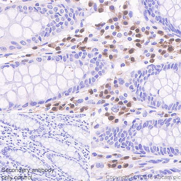 Immunohistochemistry (Formalin/PFA-fixed paraffin-embedded sections) - Anti-IRF4 antibody [SP114] - C-terminal (AB227646), expandable thumbnail