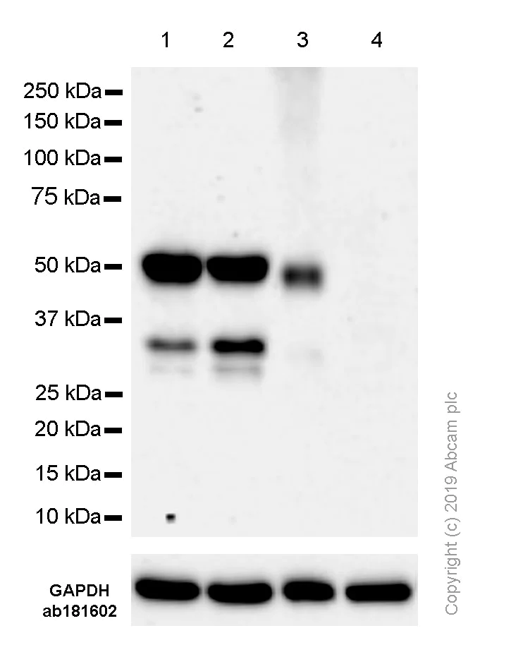 Western blot - Anti-IRF4 antibody [SP114] - C-terminal (AB227646)
