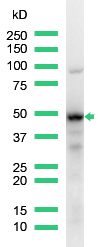Western blot - Anti-IRF4 antibody [SP114] - C-terminal (ab227646), expandable thumbnail