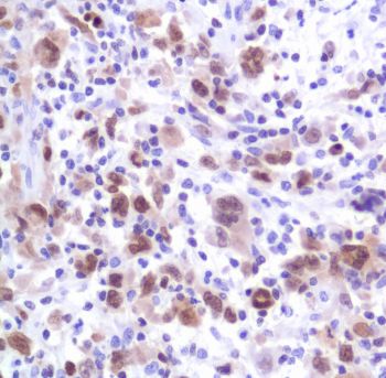 Immunohistochemistry (Formalin/PFA-fixed paraffin-embedded sections) - Anti-IRF4 antibody [SP114], prediluted (AB228154)