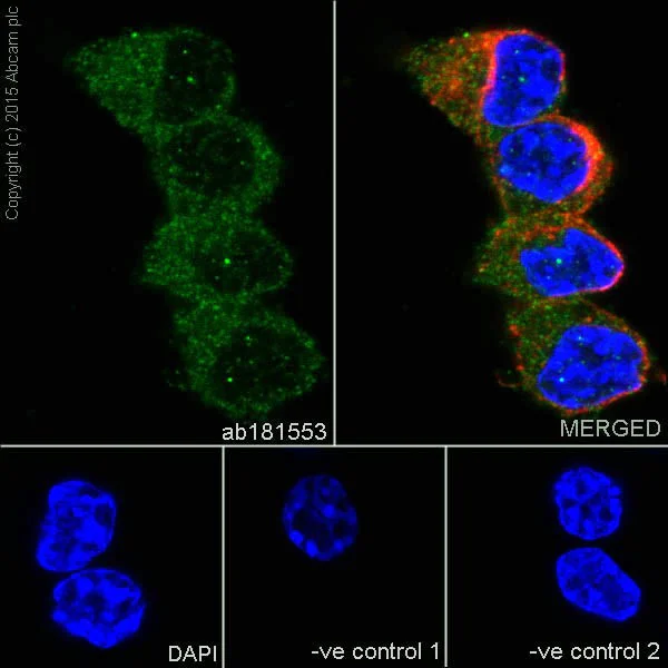 Immunocytochemistry/ Immunofluorescence - Anti-IRF5 antibody [EPR17067] (AB181553)
