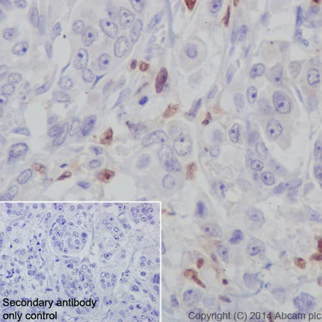 Immunohistochemistry (Formalin/PFA-fixed paraffin-embedded sections) - Anti-IRF5 antibody [EPR17067] (AB181553)