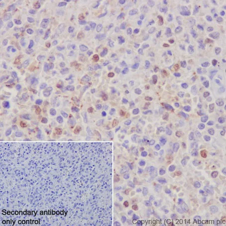 Immunohistochemistry (Formalin/PFA-fixed paraffin-embedded sections) - Anti-IRF5 antibody [EPR17067] (AB181553)