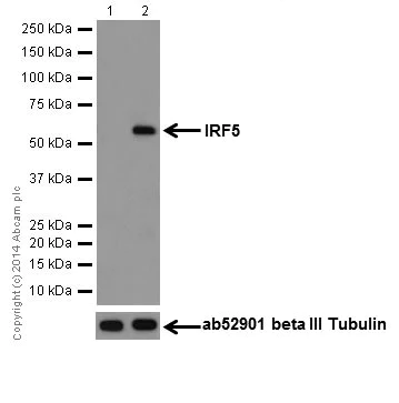 Western blot - Anti-IRF5 antibody [EPR17067] (AB181553)