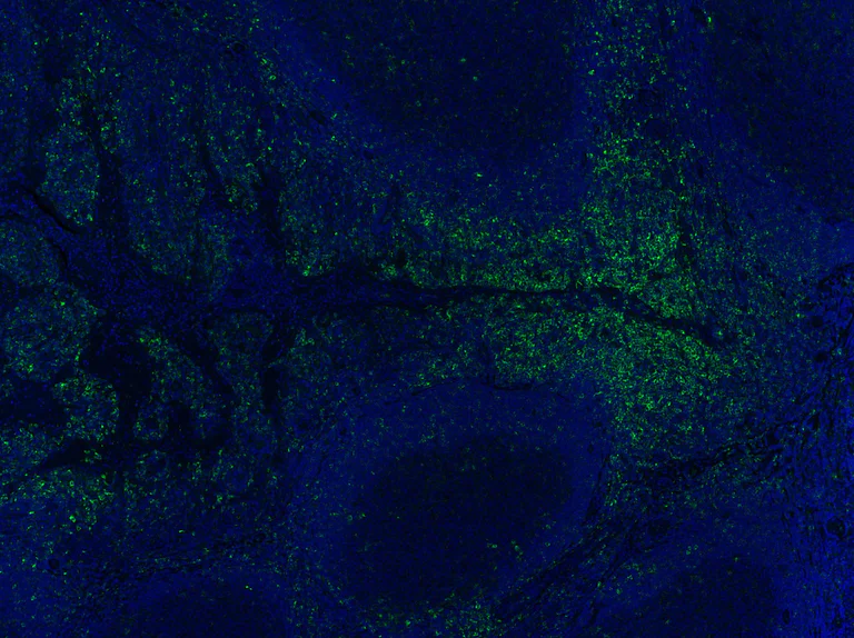 Immunohistochemistry (Formalin/PFA-fixed paraffin-embedded sections) - Anti-IRF5 antibody [EPR17067] - BSA and Azide free (AB231163)