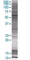 IRF5 overexpression 293T lysate (whole cell)
