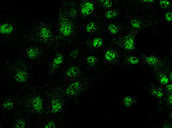 Immunocytochemistry/ Immunofluorescence - Anti-IRF6 antibody (AB275609)