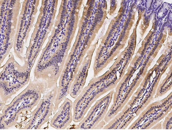 Immunohistochemistry (Formalin/PFA-fixed paraffin-embedded sections) - Anti-IRF6 antibody (AB275609)