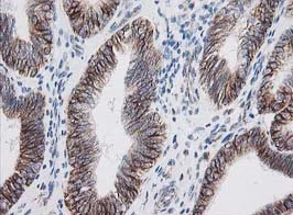 Immunohistochemistry (Formalin/PFA-fixed paraffin-embedded sections) - Anti-IRF6 antibody [OTI2A12] (AB123880)
