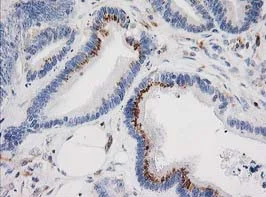 Immunohistochemistry (Formalin/PFA-fixed paraffin-embedded sections) - Anti-IRF6 antibody [OTI2A12] (AB123880)