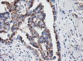 Immunohistochemistry (Formalin/PFA-fixed paraffin-embedded sections) - Anti-IRF6 antibody [OTI2A12] (AB123880)