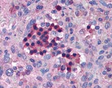 Immunohistochemistry (Formalin/PFA-fixed paraffin-embedded sections) - Anti-IRF7 antibody (AB115352)