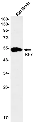 Western blot - Anti-IRF7 Antibody [S04-1E1] (AB317406)