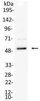 Immunoprecipitation - Anti-IRF8 antibody (AB168808)