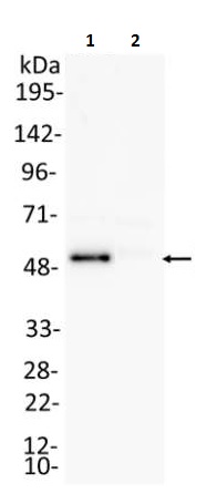 Immunoprecipitation - Anti-IRF8 antibody (AB240752)