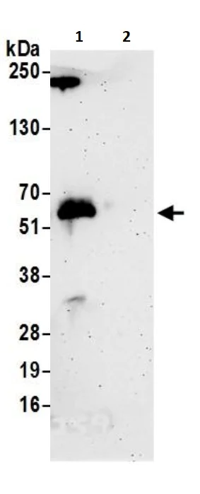 Immunoprecipitation - Anti-IRF8 antibody (AB245607)