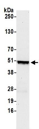 Western blot - Anti-IRF8 antibody (AB245607), expandable thumbnail