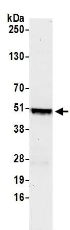 Western blot - Anti-IRF8 antibody (AB245607)