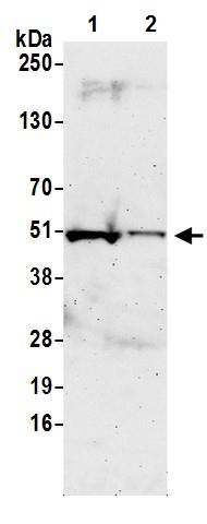 Western blot - Anti-IRF8 antibody (AB245607), expandable thumbnail