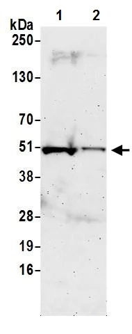 Western blot - Anti-IRF8 antibody (AB245607)