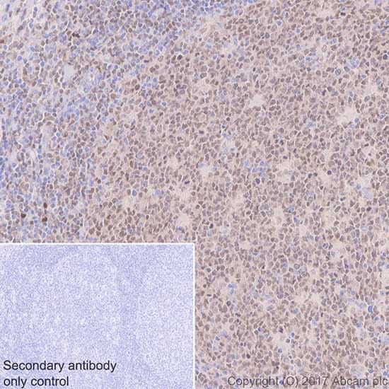 Immunohistochemistry (Formalin/PFA-fixed paraffin-embedded sections) - Anti-IRF8 antibody [EPR20441] (AB207418)