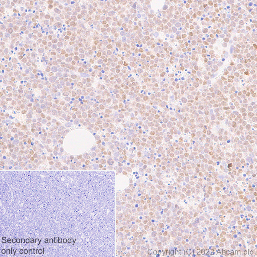 Immunohistochemistry - Anti-IRF8 antibody [EPR26381-181] (ab307292), expandable thumbnail
