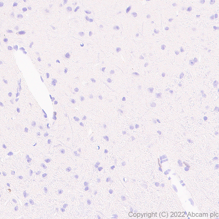 Immunohistochemistry - Anti-IRF8 antibody [EPR26381-181] (ab307292), expandable thumbnail