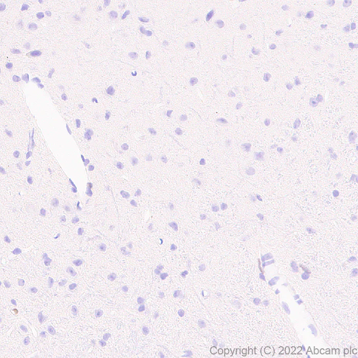 Immunohistochemistry - Anti-IRF8 antibody [EPR26381-181] (AB307292)