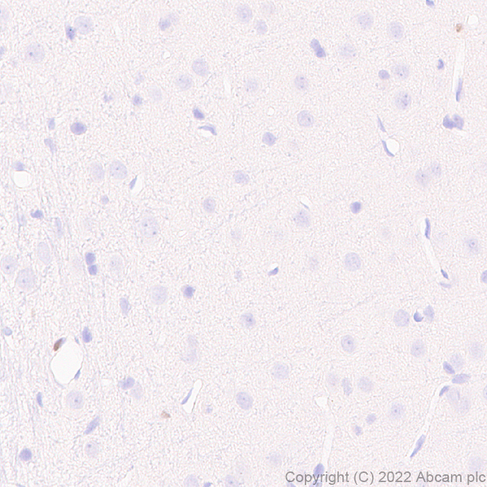 Immunohistochemistry - Anti-IRF8 antibody [EPR26381-181] (ab307292), expandable thumbnail