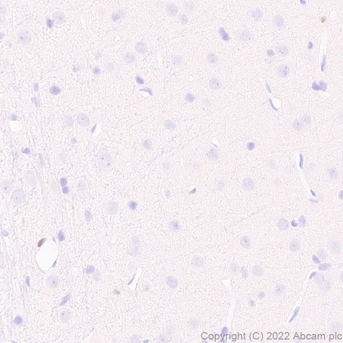 Immunohistochemistry - Anti-IRF8 antibody [EPR26381-181] (AB307292)