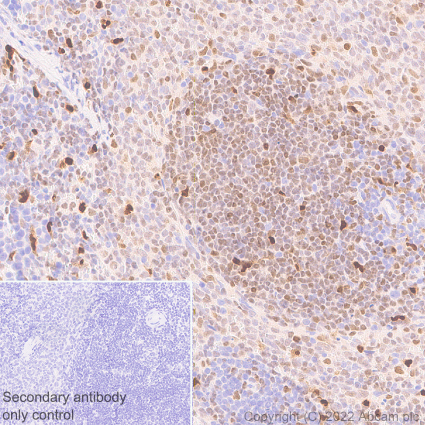 Immunohistochemistry - Anti-IRF8 antibody [EPR26381-181] (ab307292), expandable thumbnail