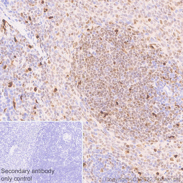 Immunohistochemistry - Anti-IRF8 antibody [EPR26381-181] (AB307292)