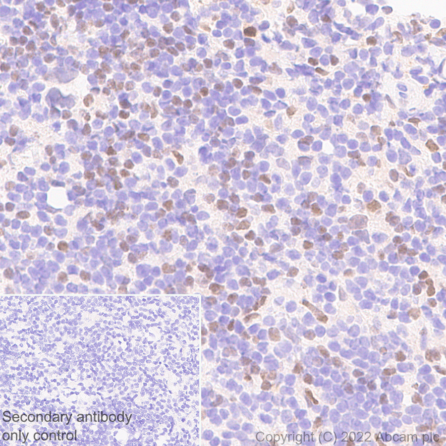 Immunohistochemistry (Formalin/PFA-fixed paraffin-embedded sections) - Anti-IRF8 antibody [EPR26382-10] - BSA and Azide free (ab306553), expandable thumbnail