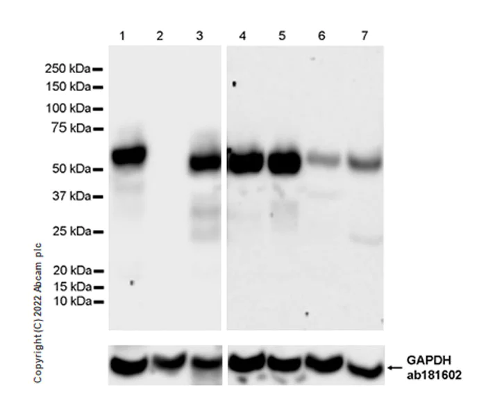Western blot - Anti-IRF8 antibody [EPR26382-10] - BSA and Azide free (AB306553)