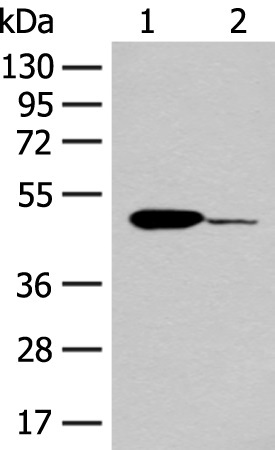 Western blot - Anti-IRG1 antibody (AB222417), expandable thumbnail